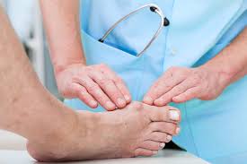 bunion deformity 與拇趾外翻：香港市民必須正視的足部健康議題